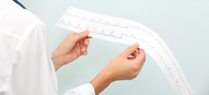 eletrocardiogramas